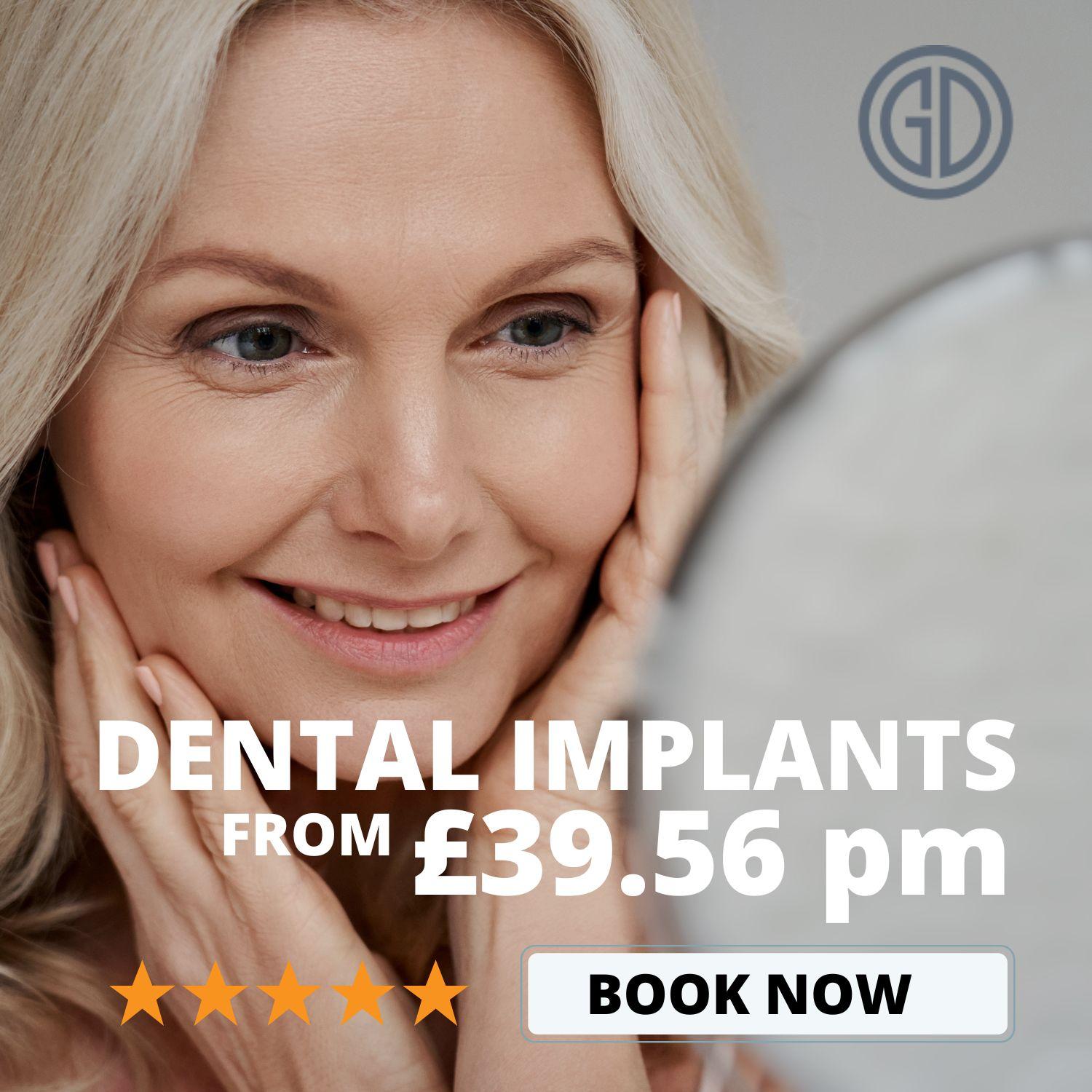 dental implant offer