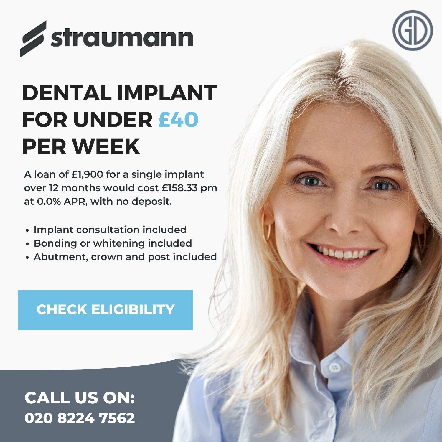 dental implant finance breakdown