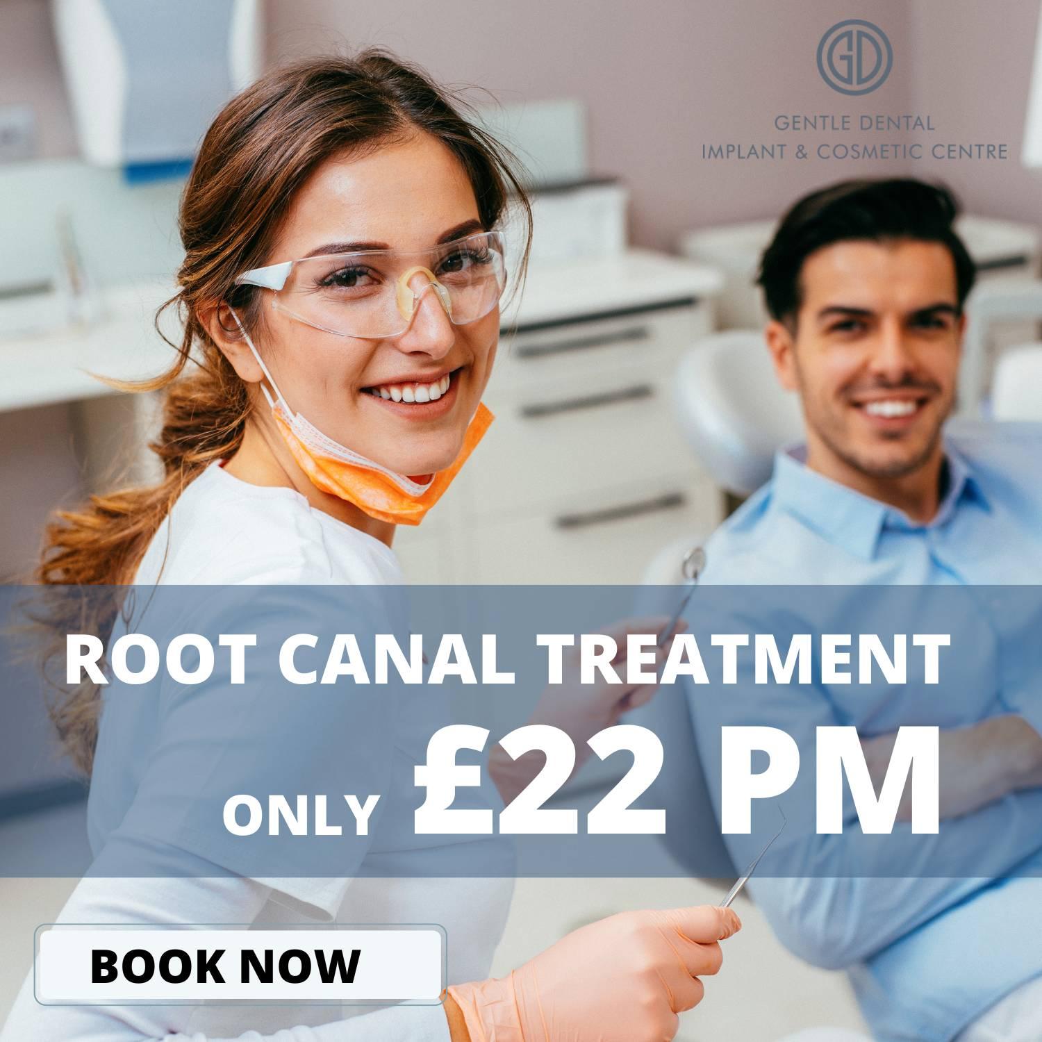 root canal offer