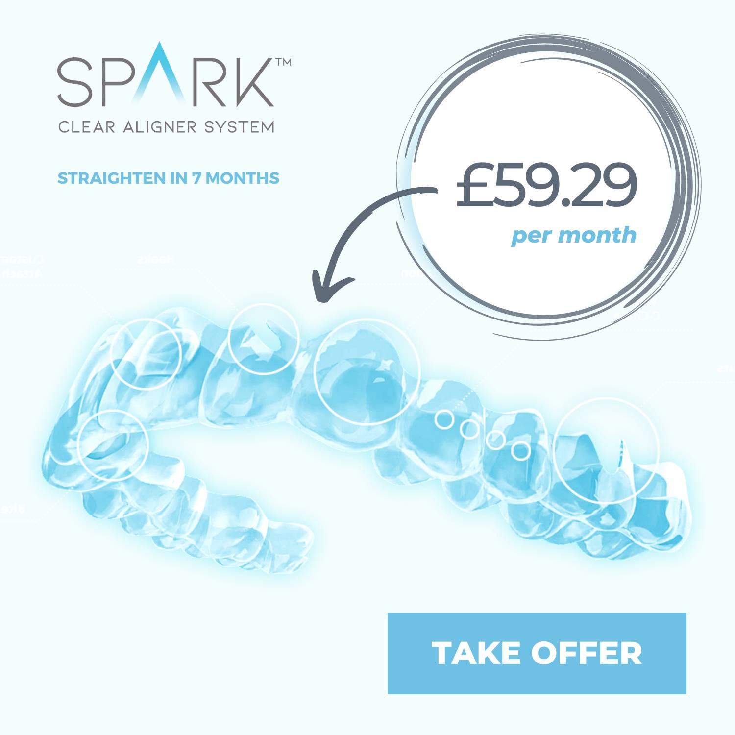 spark aligners finance offer