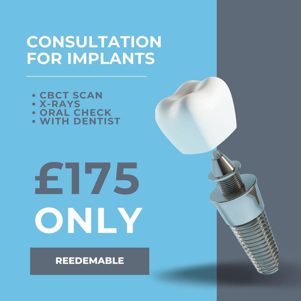 Dental Implants | Dental Implants for your missing teeth | The Gentle